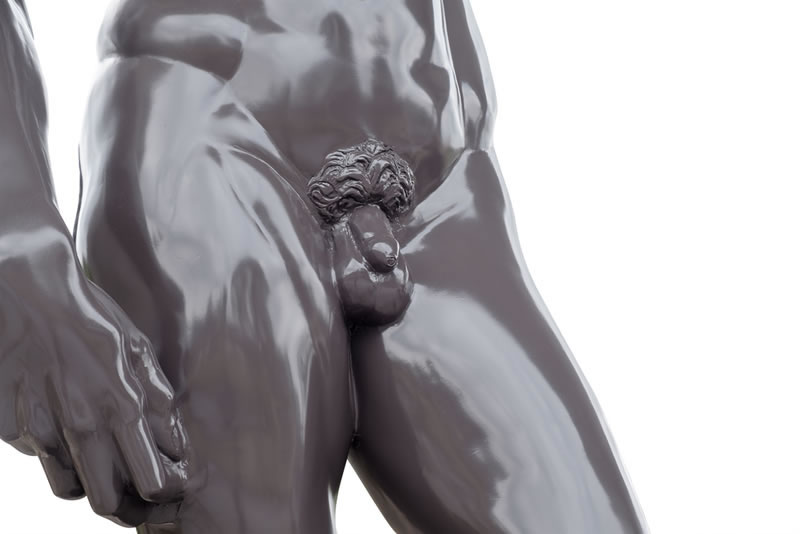 Aesthetical Male Genital Surgery