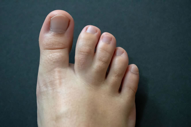 Congenital Malformations