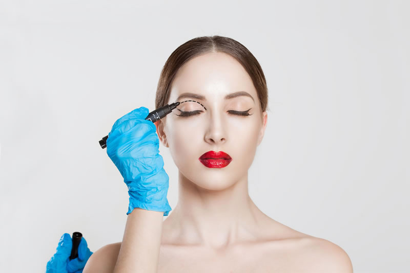 Eye Lids Surgery