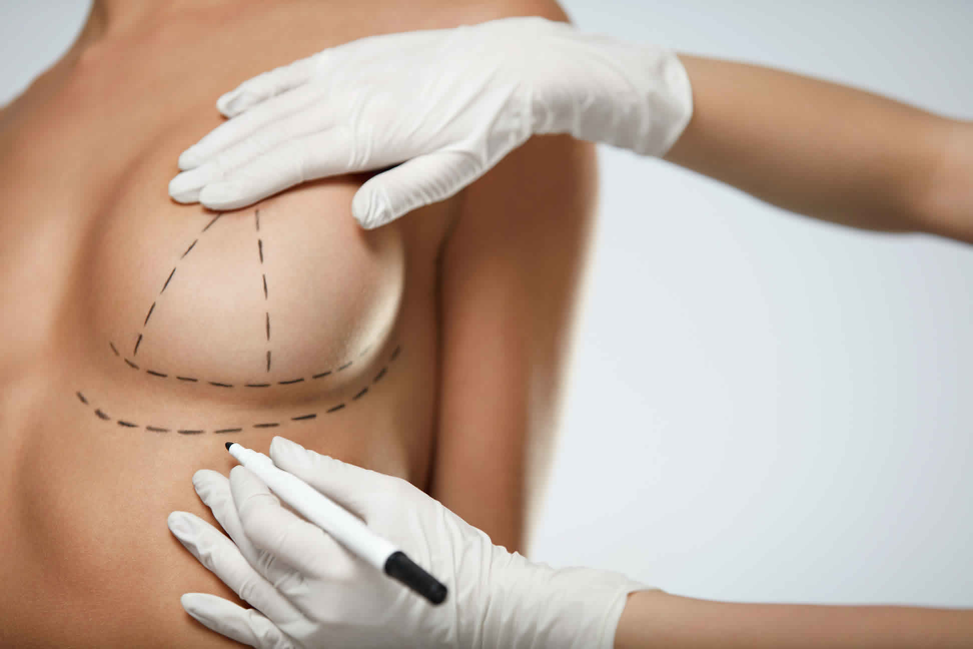 Body Surgerys
